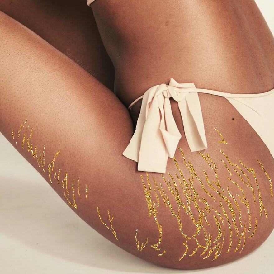 Artist Turns Stretch Marks Into Art In Order To Encourage People To Be Proud Of Them