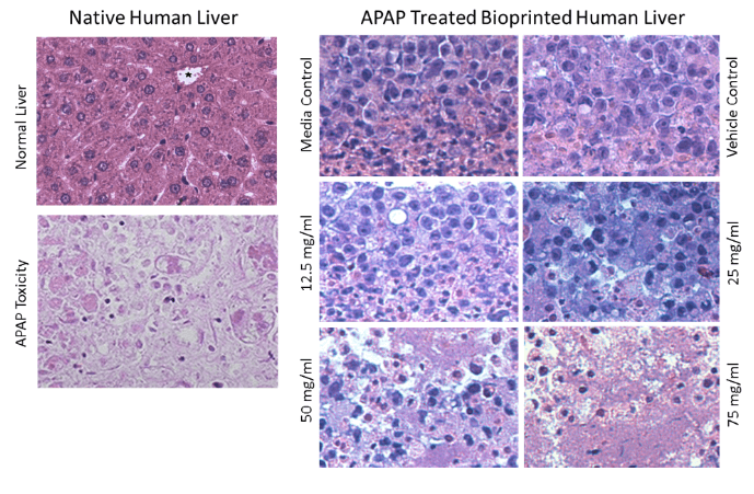 Organovo Gets Orphan Drug Designation for 3D Printed Liver Tissue