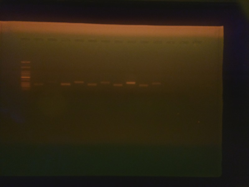 The DNA gel imager exposes elements of DNA suspended in agarose gel