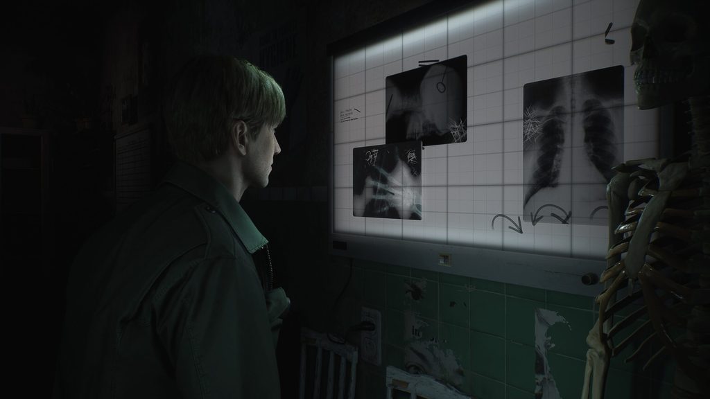 exterior crema acortar Silent Hill 2 remake revealed, first gameplay details and design changes  announced | Blogdot.tv